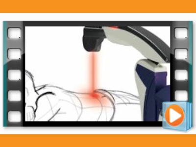 MLS Laser Therapy Q&A